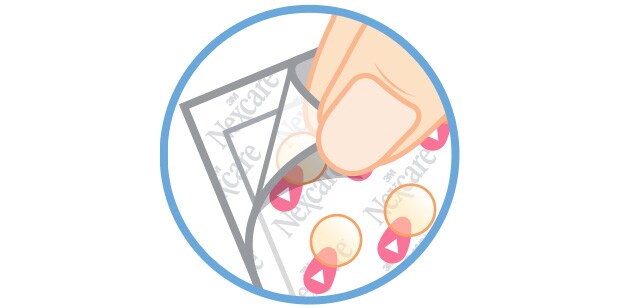 Illustration de doigts décollant le coin de la pellicule de couverture pour exposer les timbres pour acné.